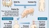 Symptoms of Swine flu